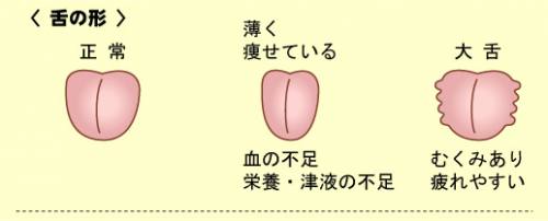 ファイル名: tan-fig.jpg
ファイルサイズ: 28.4KB
→クリックで元のサイズを表示 tan-fig