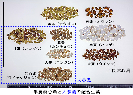 下痢 産後 腹痛