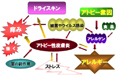 アトピー性皮膚炎の成り立ち