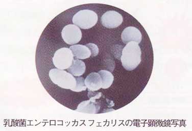 乳酸菌エンテロコッカスフェカリスの電子顕微鏡写真