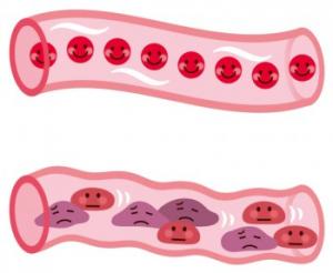 HDL_Cholesterol
