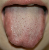 ファイル名: NONALNUM-UE1T6IiM6Ki6-E.jpg
ファイルサイズ: 29.3KB NONALNUM-UE1T6IiM6Ki6-E