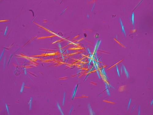 800px-Fluorescent_uric_acid