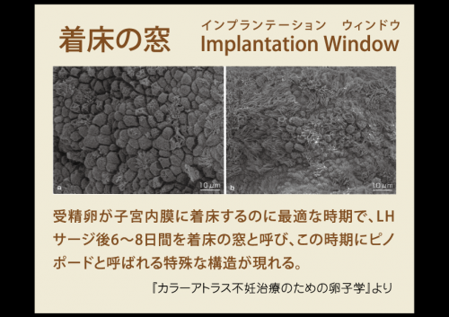 ファイル名: NONALNUM-5a2Q5a6d44K144OdcDUtMuedgOW6iuOBrueqkw-E.png
ファイルサイズ: 208.7KB NONALNUM-5a2Q5a6d44K144OdcDUtMuedgOW6iuOBrueqkw-E