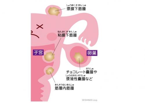 ファイル名: NONALNUM-5a2Q5a6d44K144OdcDIz5a2Q5a6u5YaF6Iac55eH44Gq44Gp-E.jpg
ファイルサイズ: 14KB NONALNUM-5a2Q5a6d44K144OdcDIz5a2Q5a6u5YaF6Iac55eH44Gq44Gp-E