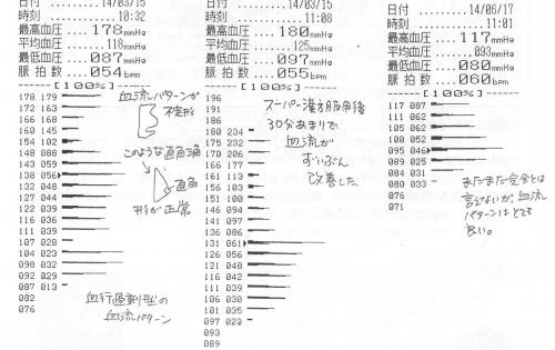ファイル名: NONALNUM-MjAxNDA355eH5L6L44Kw44Op44OV-E.jpg
ファイルサイズ: 30.8KB NONALNUM-MjAxNDA355eH5L6L44Kw44Op44OV-E